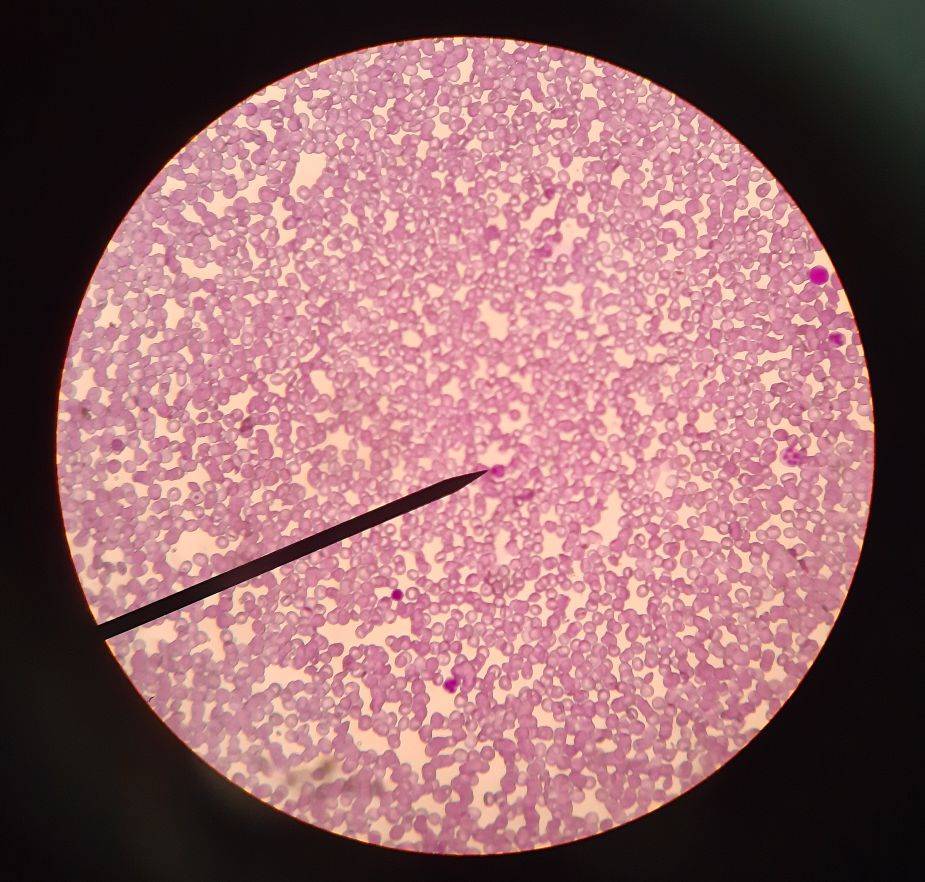 در چهارمین جلسه انجمن زیستشناسی سلولهای بنیادی رنگ آمیزی شدند.