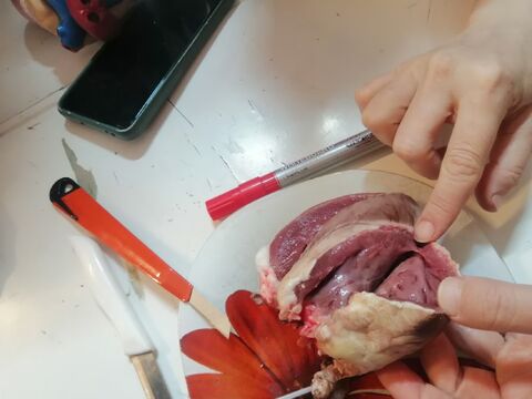 ویژه برنامه ی اهدای خون