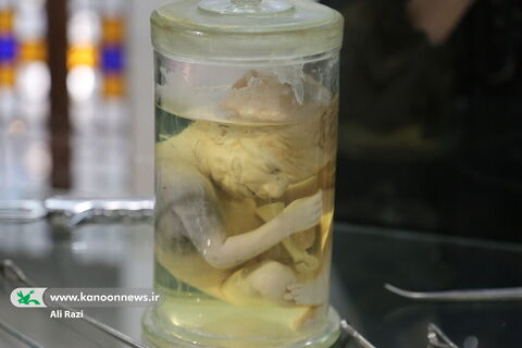 آلبوم تصویری بازدید اعضا نوجوان کانون استان بوشهر از موزه ی تاریخ پزشکی خلیج فارس