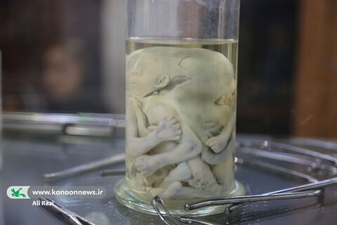 آلبوم تصویری بازدید اعضا نوجوان کانون استان بوشهر از موزه ی تاریخ پزشکی خلیج فارس